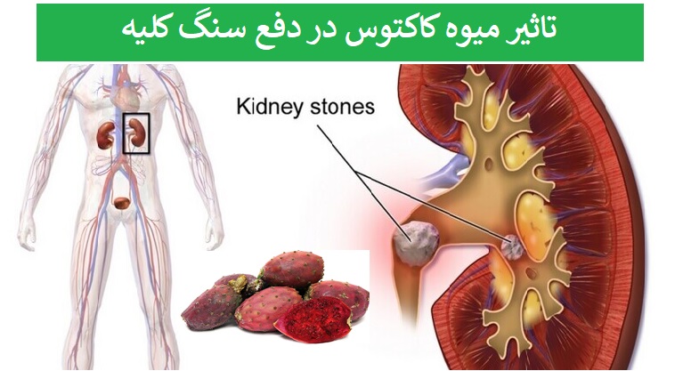 تاثیر میوه کاکتوس در دفع سنگ کلیه